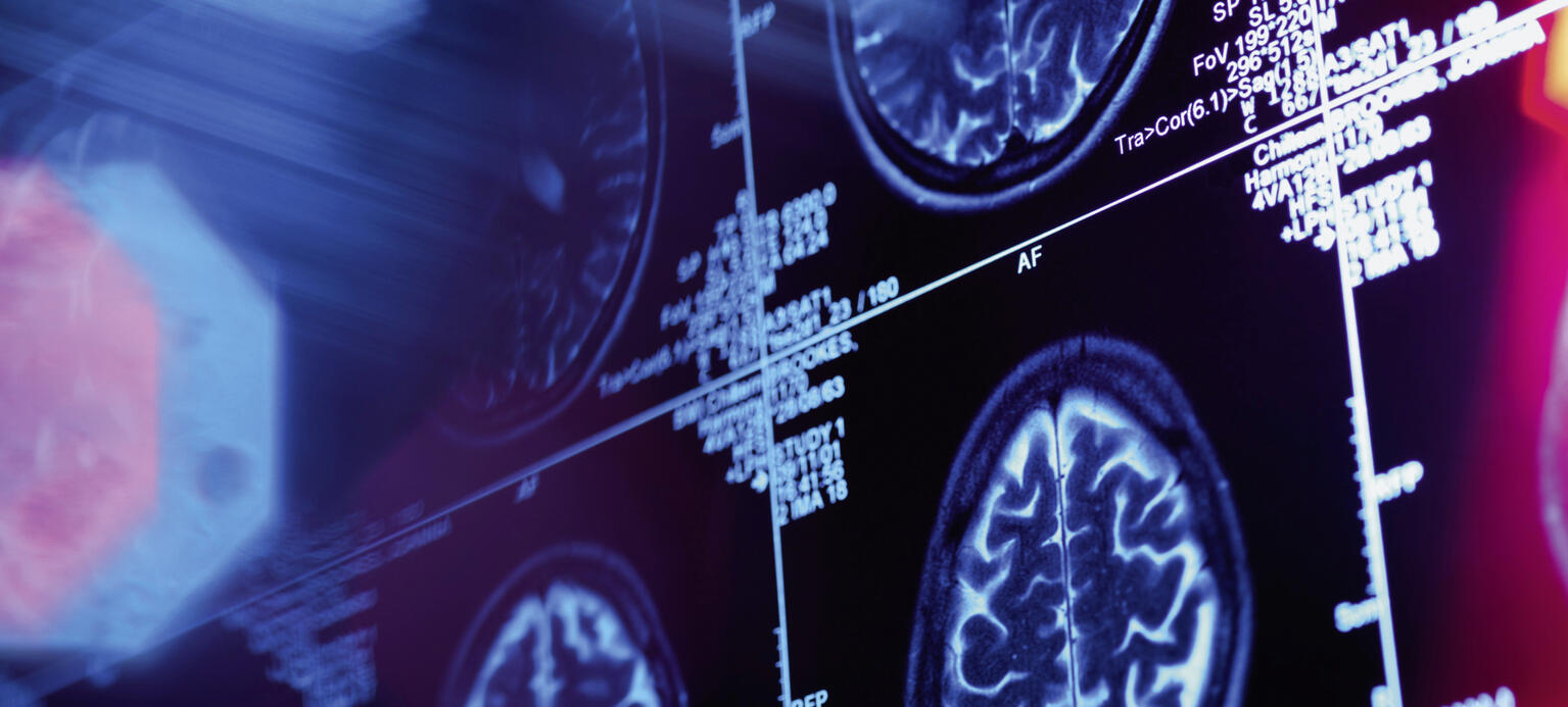 Zerlegt aber nicht entschlüsselt – die Wissenschaft versucht das menschliche Gehirn nachzubauen, aber die KI reicht noch lange nicht an es heran.